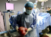 朝陽婦產(chǎn)醫(yī)院成功實(shí)施巨大子宮肌瘤全子宮雙附件切除術(shù)